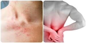 Những dấu hiệu và triệu chứng suy thận nhẹ bạn cần biết