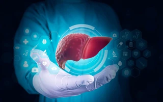 Ba điều nguy hiểm nhất đối với người bị gan nhiễm mỡ